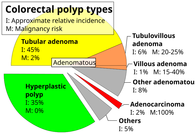 File:Pie chart of colorectal polyp etiologies.svg