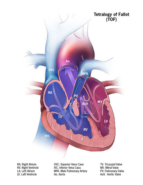 File:Teralogy web.jpg