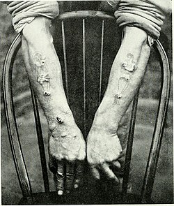 The British journal of dermatology (1888) (14594612510).jpg
