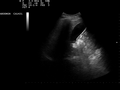 Thumbnail for version as of 13:19, 8 January 2011