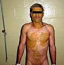 An Iraqi detainee with human excreta smeared on his face and body Abu ghraib feces 06a.jpg