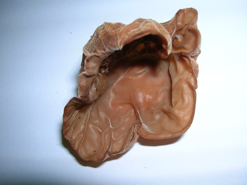 File:Auricularia auricula-judae Eglinton.JPG