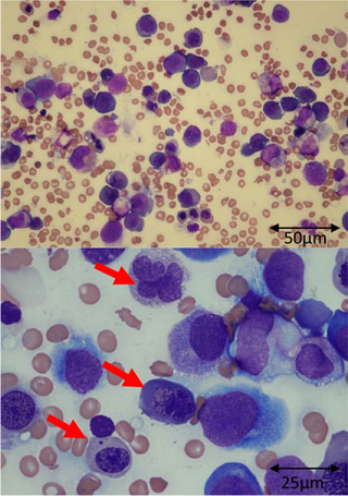 May–Grünwald stain