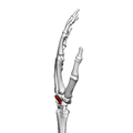 Capitate bone (left hand) 03 radial view.png
