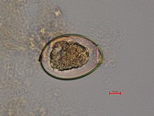 diphyllobothriasis biohelminth feljegyzés az aszcariasisról
