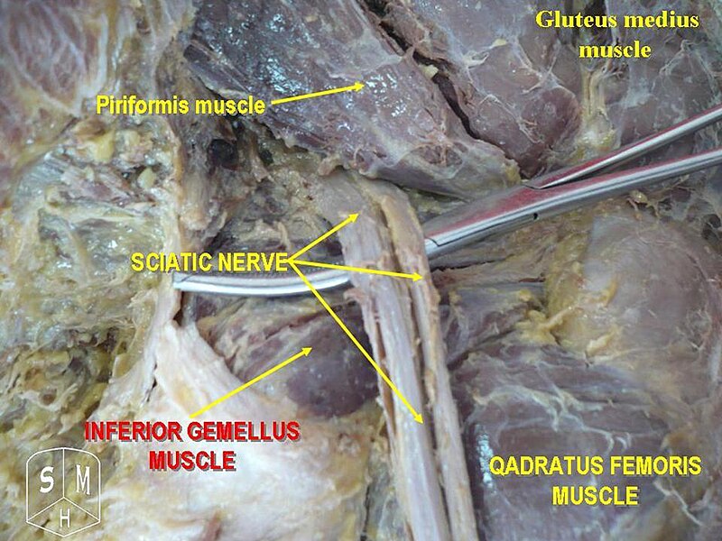 File:Gluteus medius muscle.jpg