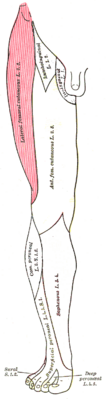 Gebied van innervatie van de laterale femorale huidzenuw