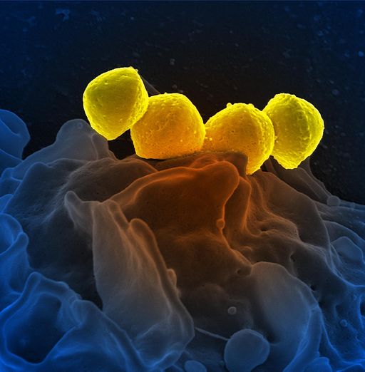 Group A Streptococcus Bacteria on Human Neutrophil (8517040030)