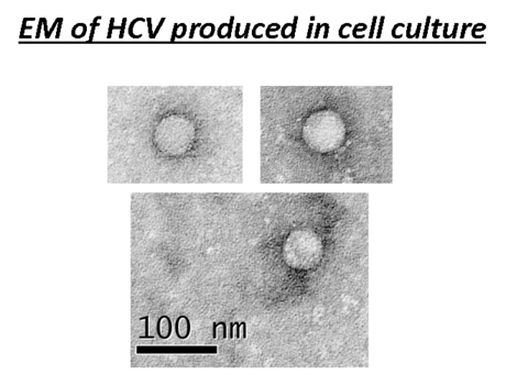 File:HCV pictures.png