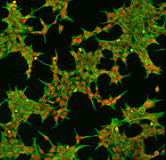 Immunofluorescent Human Embryonic Kidney 293 cells