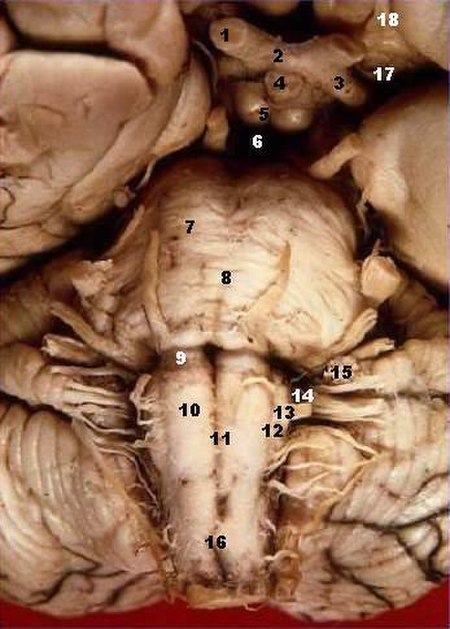 ไฟล์:Human_brainstem_anterior_view_description.JPG