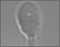 Miniatura para Inyección intracitoplasmática de espermatozoides morfológicamente seleccionados