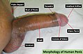 Morphology of Human penis.jpg