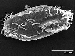 The ciliate Oxytricha trifallax with cilia clearly visible
