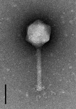 A Salmonellá-t fertőző pSal-SNUABM-04 fág elektronmikroszkópos képe