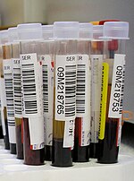 Lakaran kecil untuk Ujian darah