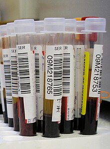 Blood test.jpg