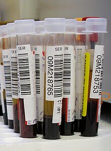 eat glucose test blood before Wikipedia   Blood test