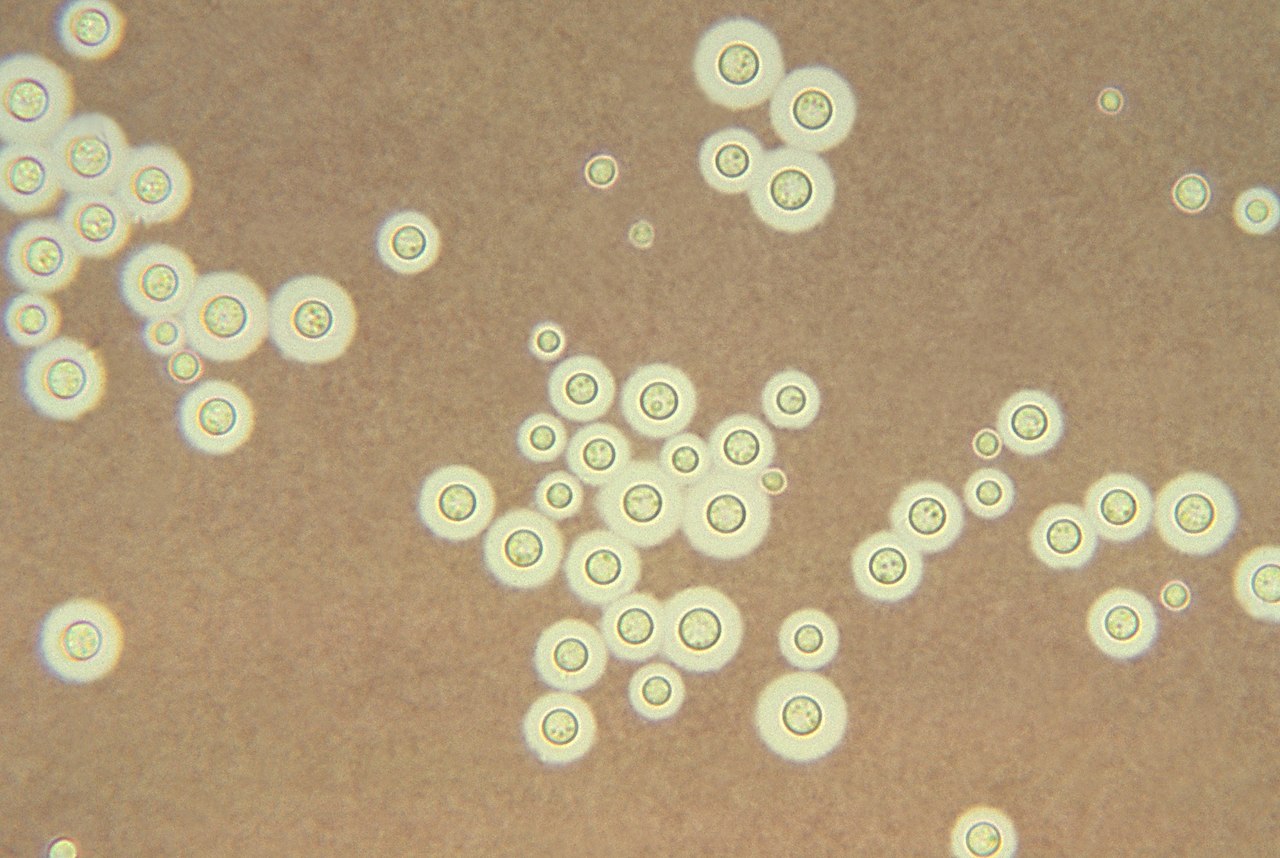 1280px-Cryptococcus_neoformans_using_a_light_India_ink_staining_preparation_PHIL_3771_lores.jpg