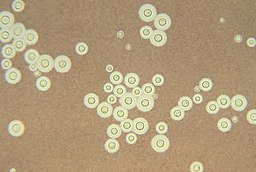Cryptococcus neoformans using a light India ink staining preparation PHIL 3771 lores