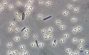 Bakterier af slægten Bacillus med endosporer (ufarvet, fasekontrastmikroskopi)