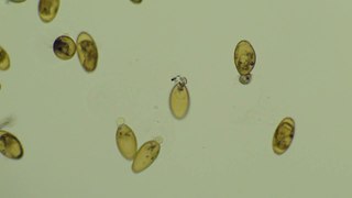 parazita fasciola enterobiosis miért