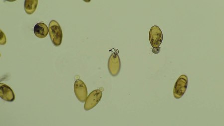 ไฟล์:Hatching of F. hepatica miracidia.ogv