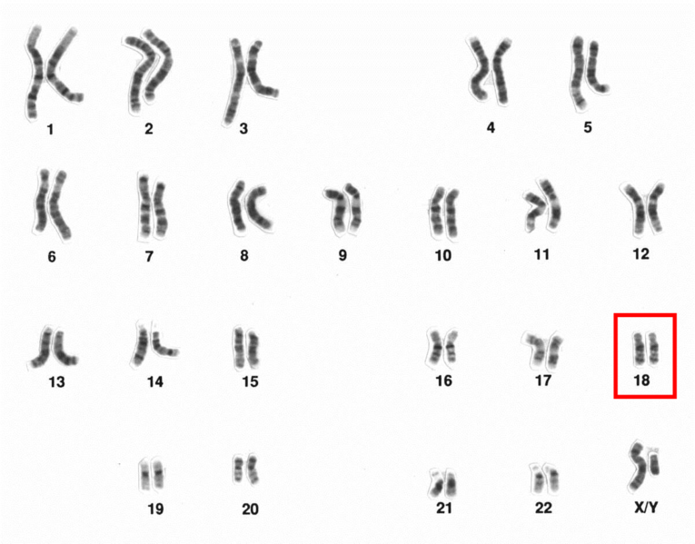 File:Human male karyotpe high resolution - Chromosome 18.png