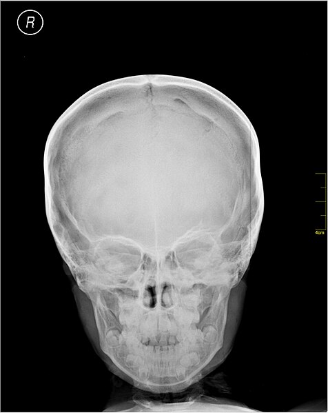 File:Medical X-Ray imaging QBE06 nevit.jpg