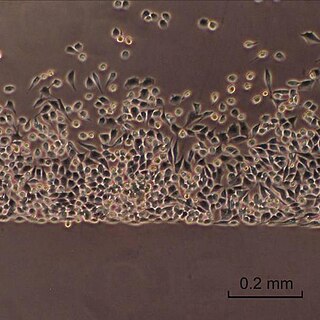 <span class="mw-page-title-main">Baby hamster kidney cell</span>