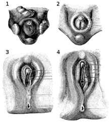 Frenillo de los labios menores - Wikipedia, la enciclopedia libre