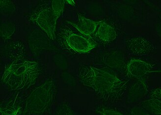 Immunofluorescence staining pattern of vimentin antibodies. Produced by incubating vimentin primary antibodies and FITC labelled secondary antibodies with HEp-20-10 cells. VIMENTIN.jpg