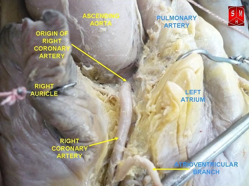 File:Coronary arteries 2.jpg