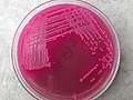 Thumbnail for File:E. coli lactose fermenter (LF) colonies on MacConkey agar.jpg