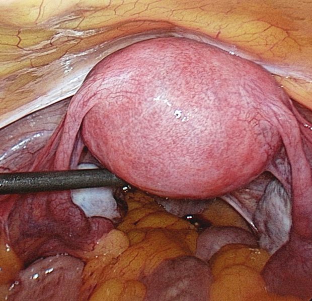 File:Female reproductive system.jpg