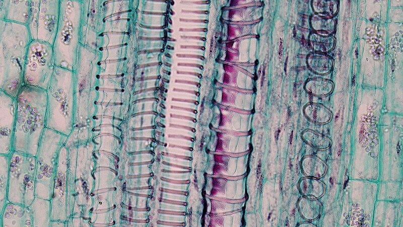 File:Herbaceous Dicot Stem Xylem Vessels Cucurbita (35463815631).jpg