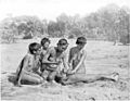 Das rituelle Ausschlagen eines Frontzahns beim Stamm der Kaytetye (Aborigines) Australiens, als Initiationsritus durchgeführt