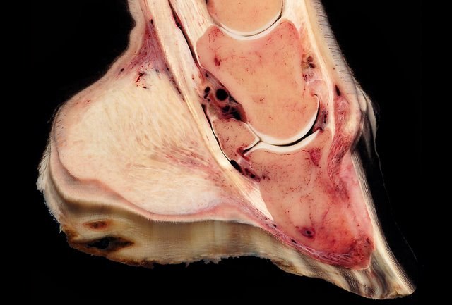 Hoof sagittal section with massive inflammation and rotation of third phalanx