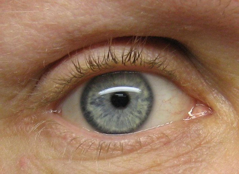 File:Light Blue Eye IMG 4057.JPG