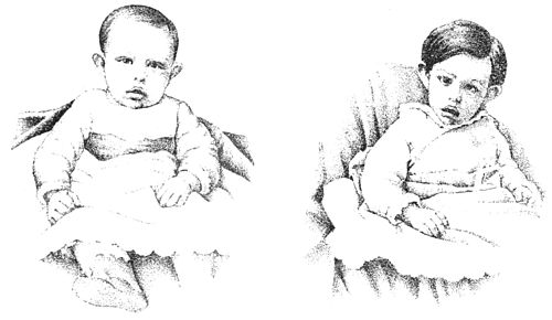 PSM V35 D406 A little boy at the ages of six and eighteen months.jpg