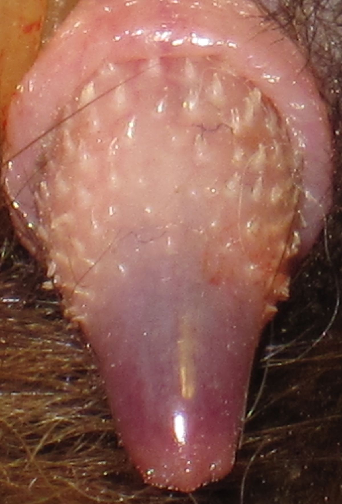 Penile spines - Wikipedia