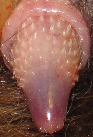 <span class="mw-page-title-main">Penile spines</span> Pointed structures on the penile glans and/or shaft