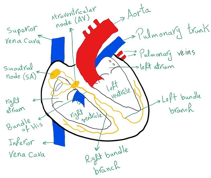 Second-degree atrioventricular block (fetal echocardiography