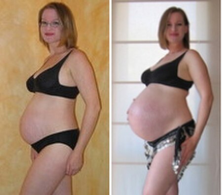 Tập_tin:Pregnancy_comparison.jpg