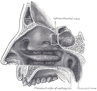 Sphenoethmoidal recess