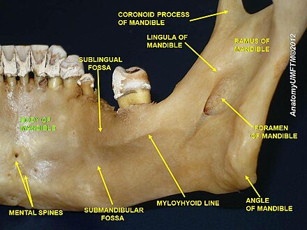 Body and ramus of the mandible. The mandibular foramen is labeled on the right. The lingula is just above the mandibular foramen.