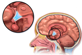 Hypothalamus location.