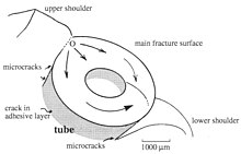 Fracture map of failed breast implant Fract map1.jpg