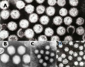 Viry způsobující gastroenteritidu: A = rotavirus, B = adenovirus, C = norovirus a D = astrovirus. Částice virů jsou zobrazeny při stejném optickém zvětšení, aby bylo možno porovnat jejich velikost.