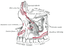 maxilla törés